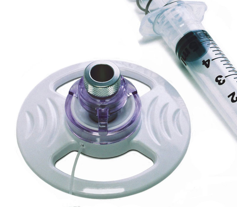 Corneal Transplantation